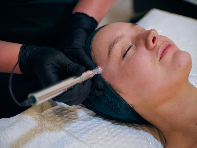 Skin Needling