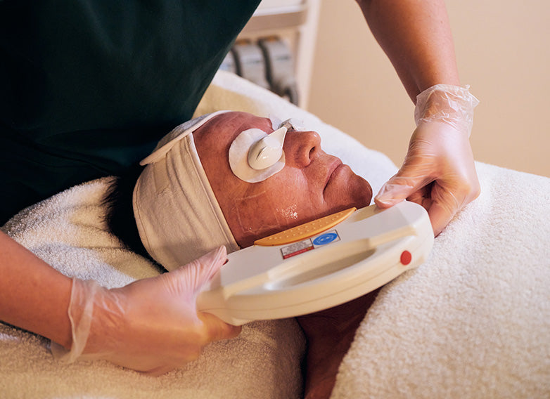 IPL Facial Therapy