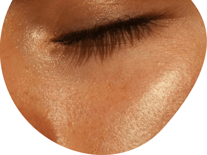 Skin concerns banner image